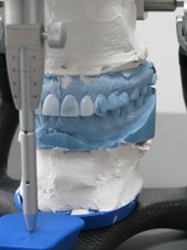 Wax-up